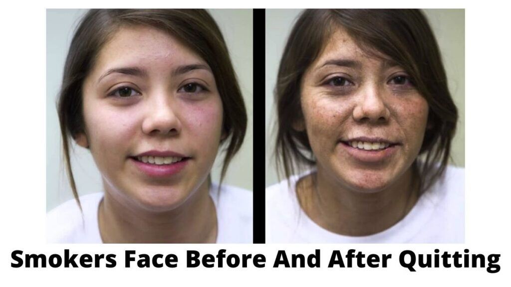 smokers face before and after - quit smoking benefit