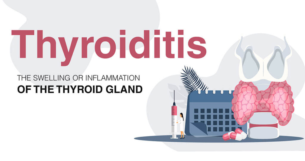 Thyroiditis UK | Under Active Thyroid Symptom Review