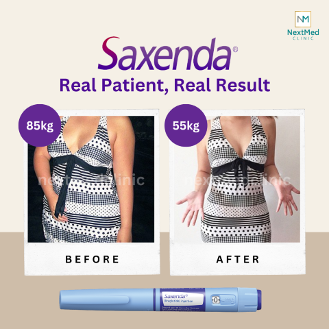 Saxenda Weight Loss Before and After Pictures