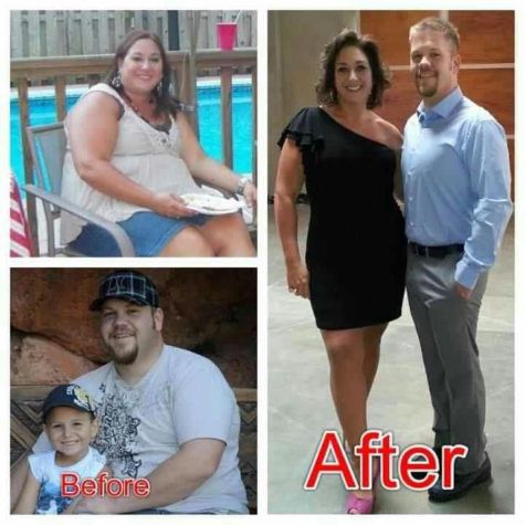 mysimba weight loss before after piccs