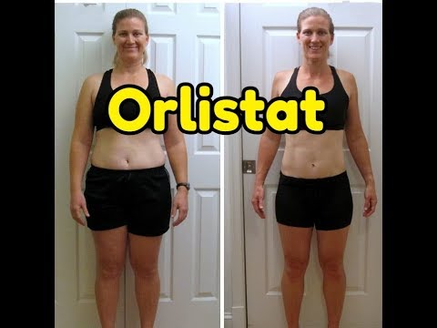 orlistat-weight-loss-before-after-piccs