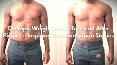 ozempic-weight-loss-pictures-before-after